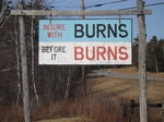 insure_burns.jpg