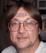 loser-forehead.jpg